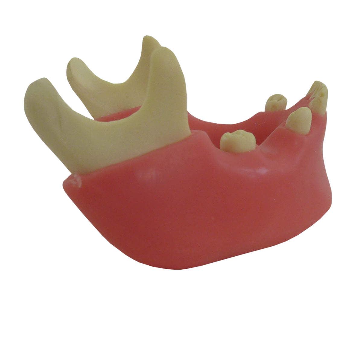 4401G-02 - PREMOLAR MODEL WITH ENCLOSED 3RD MOLAR AND GUM