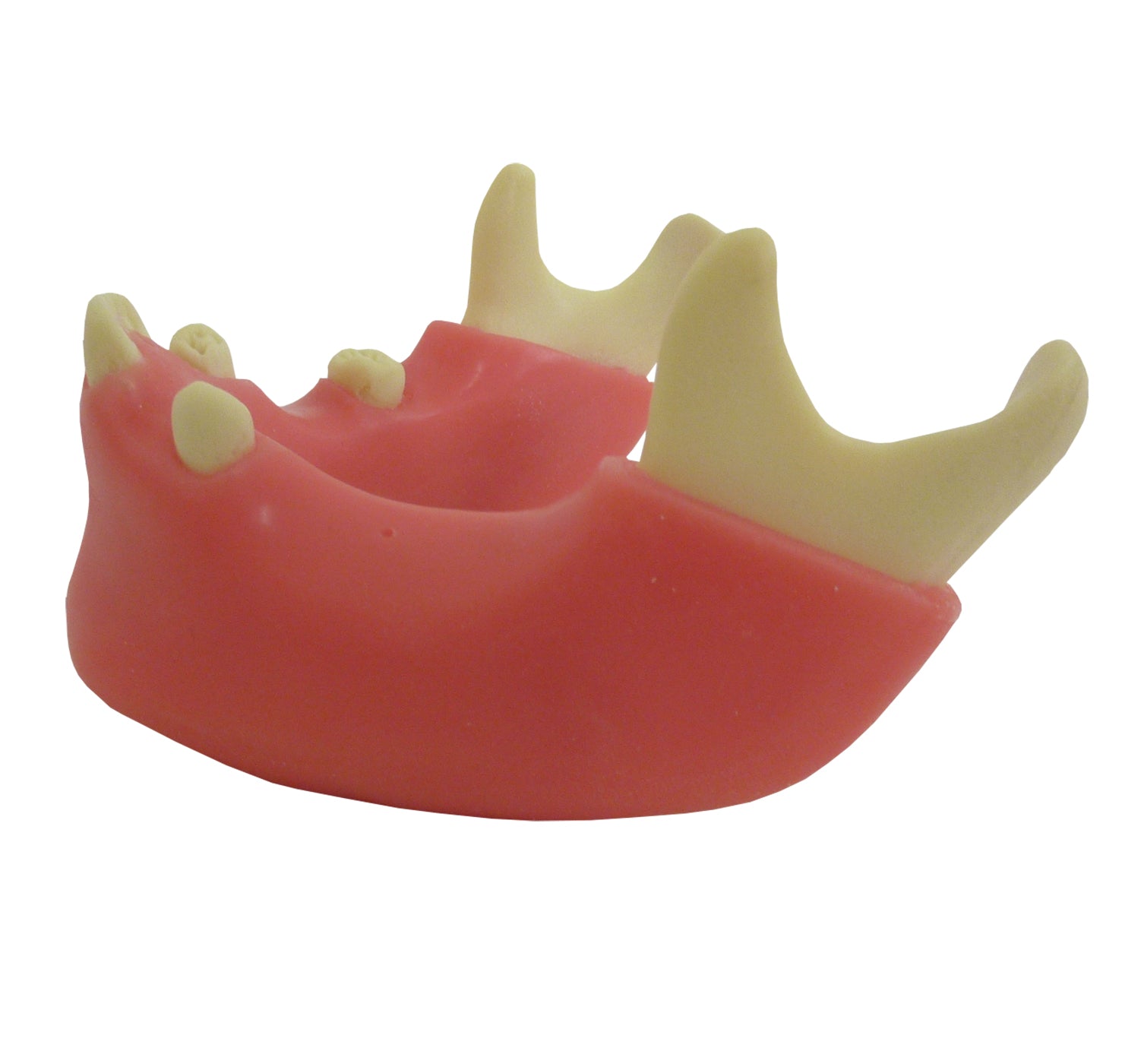 4401G-02 - PREMOLAR MODEL WITH ENCLOSED 3RD MOLAR AND GUM
