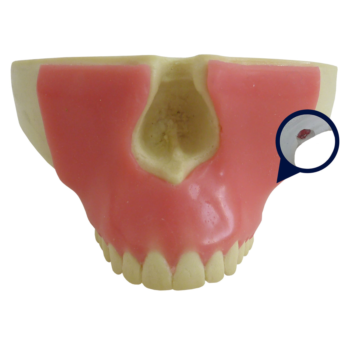 4402G-01 - MAXILLA WITH ALL TEETH AND GUM + 3RD MOLAR ENCLOSED