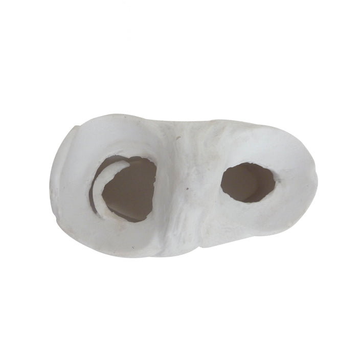6000-01 - WHITE MENISCUS MODEL (WITH SUTURE CUTS)
