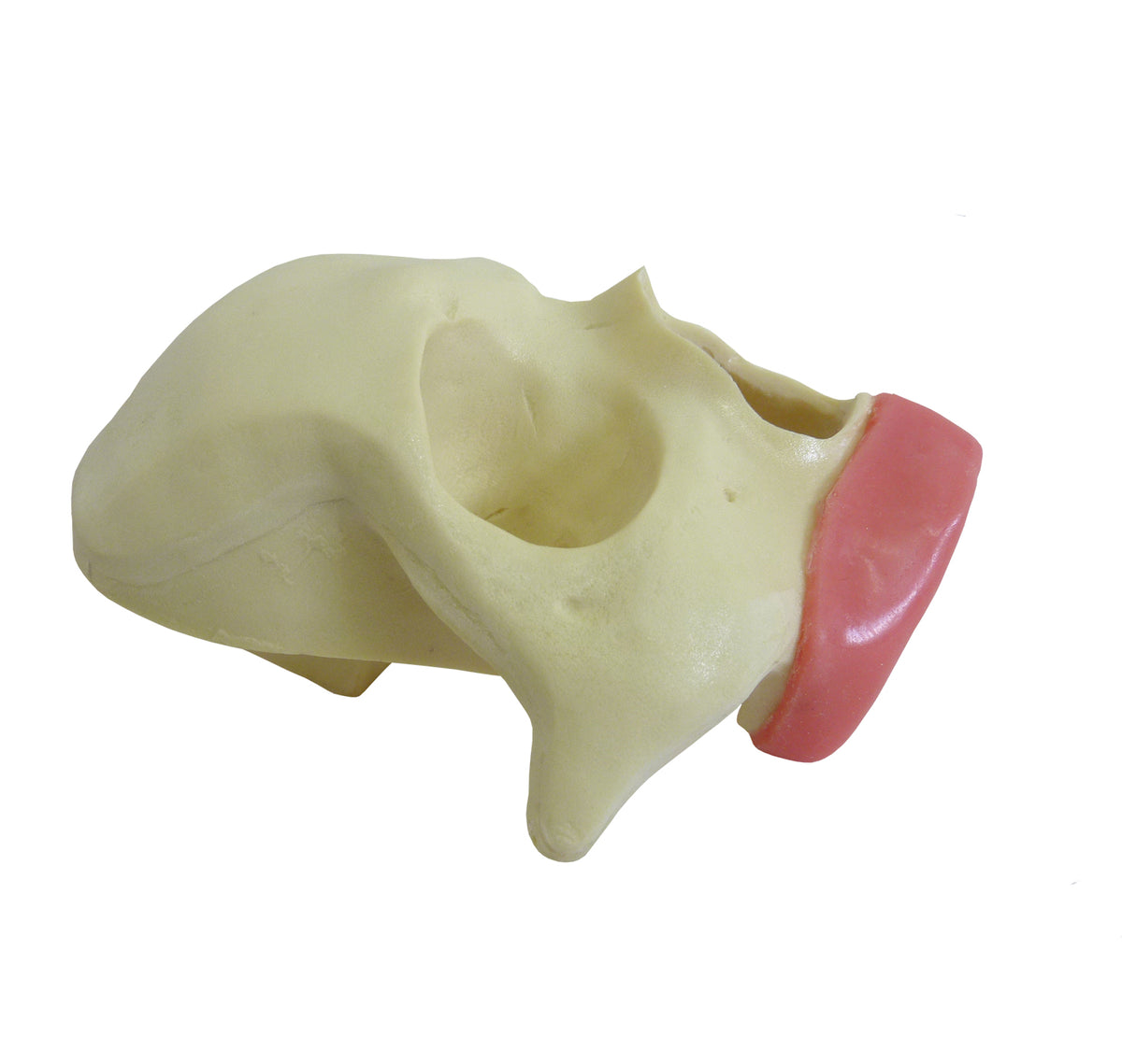 9012G - FRONTAL SKULL - ALL ON 4 - STANDARD WITH GUM