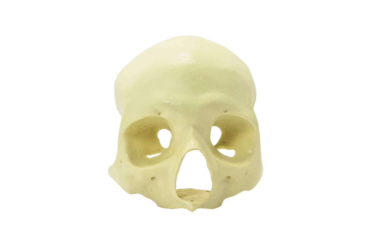 9014 - FRONTAL SKULL - ALL ON 4 - ZYGOMA