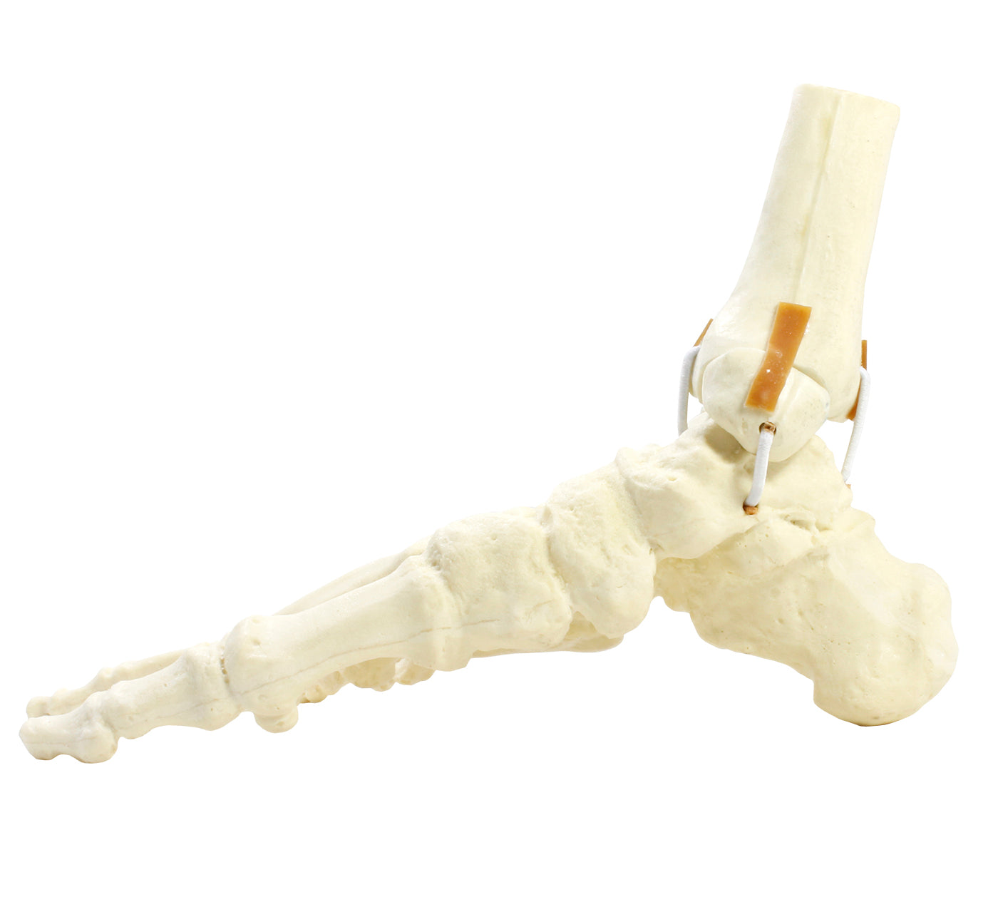 9699 - RIGHT ANKLE - FRACTURE 1