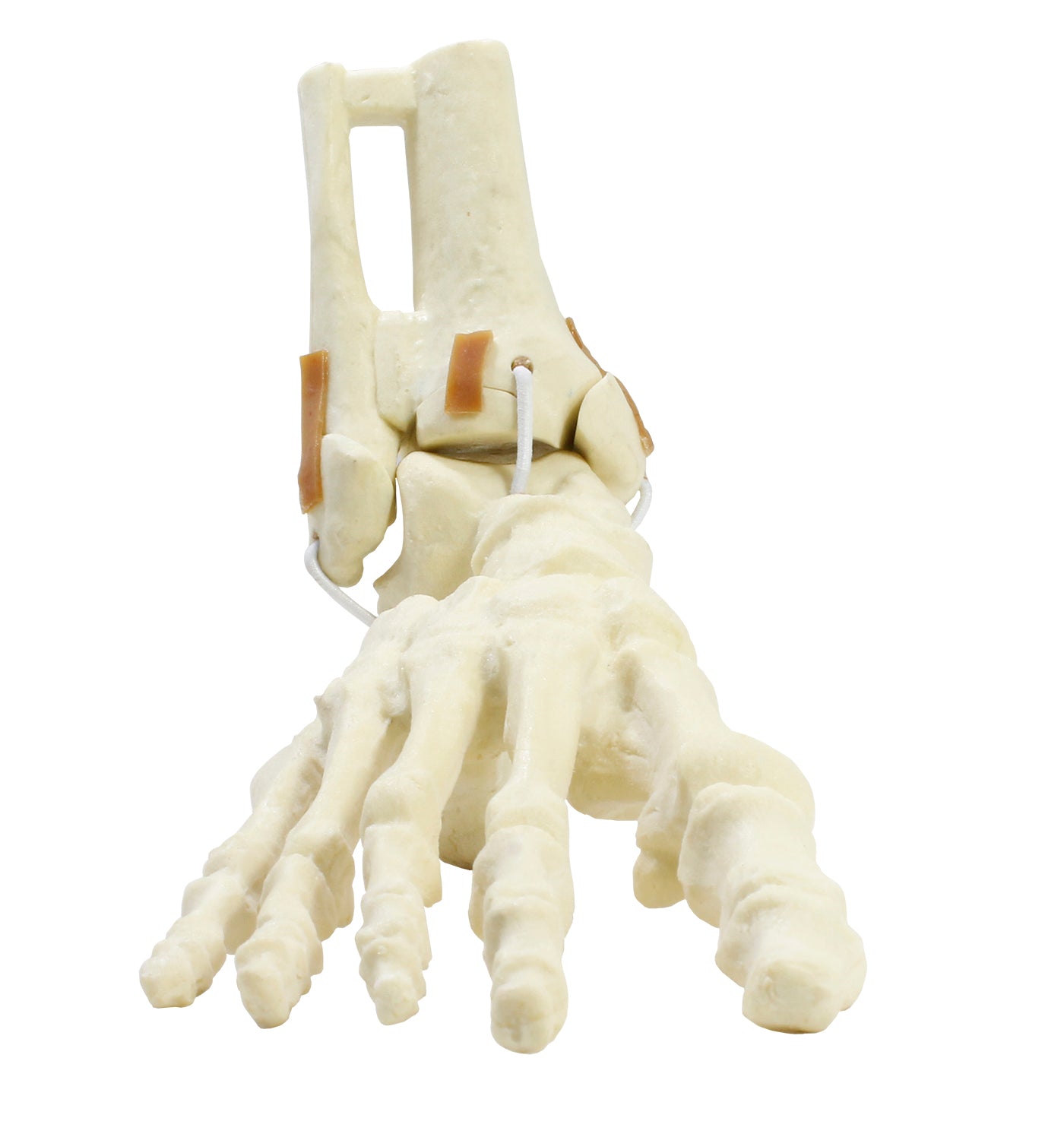 9699 - RIGHT ANKLE - FRACTURE 1