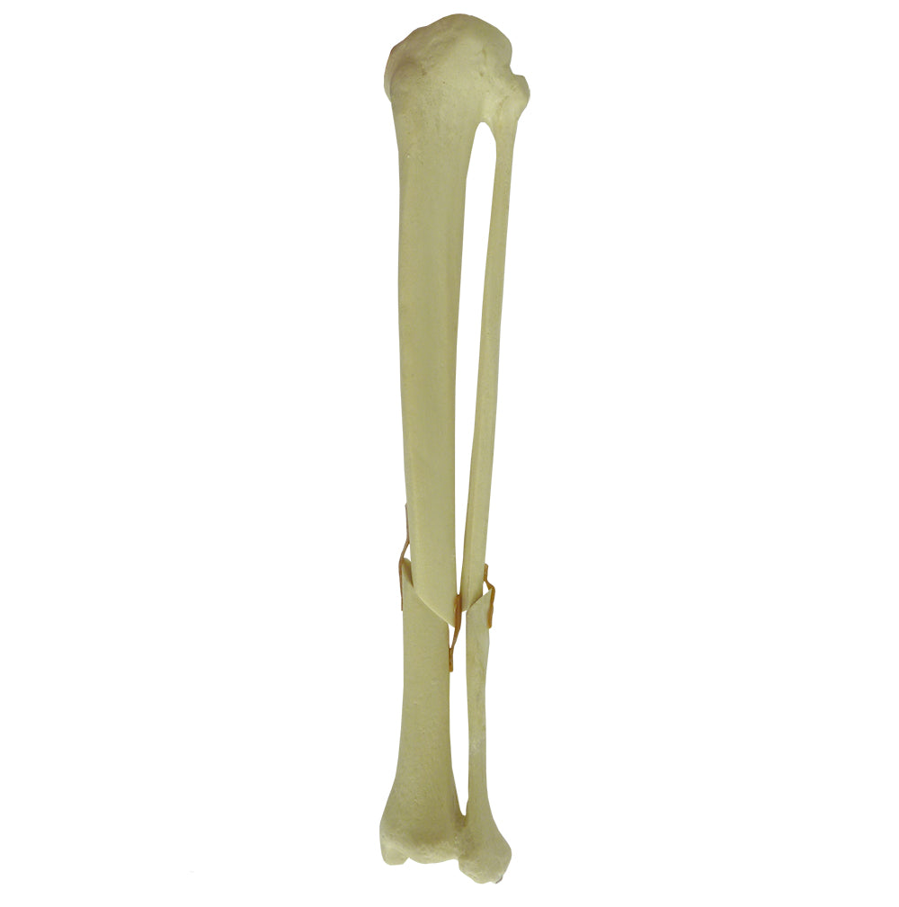 9701 - LEFT TIBIA WITH OBLIQUE FRACTURE