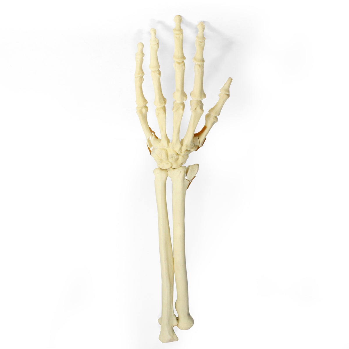 9705 - LEFT HANDLE - FRACTURE 1