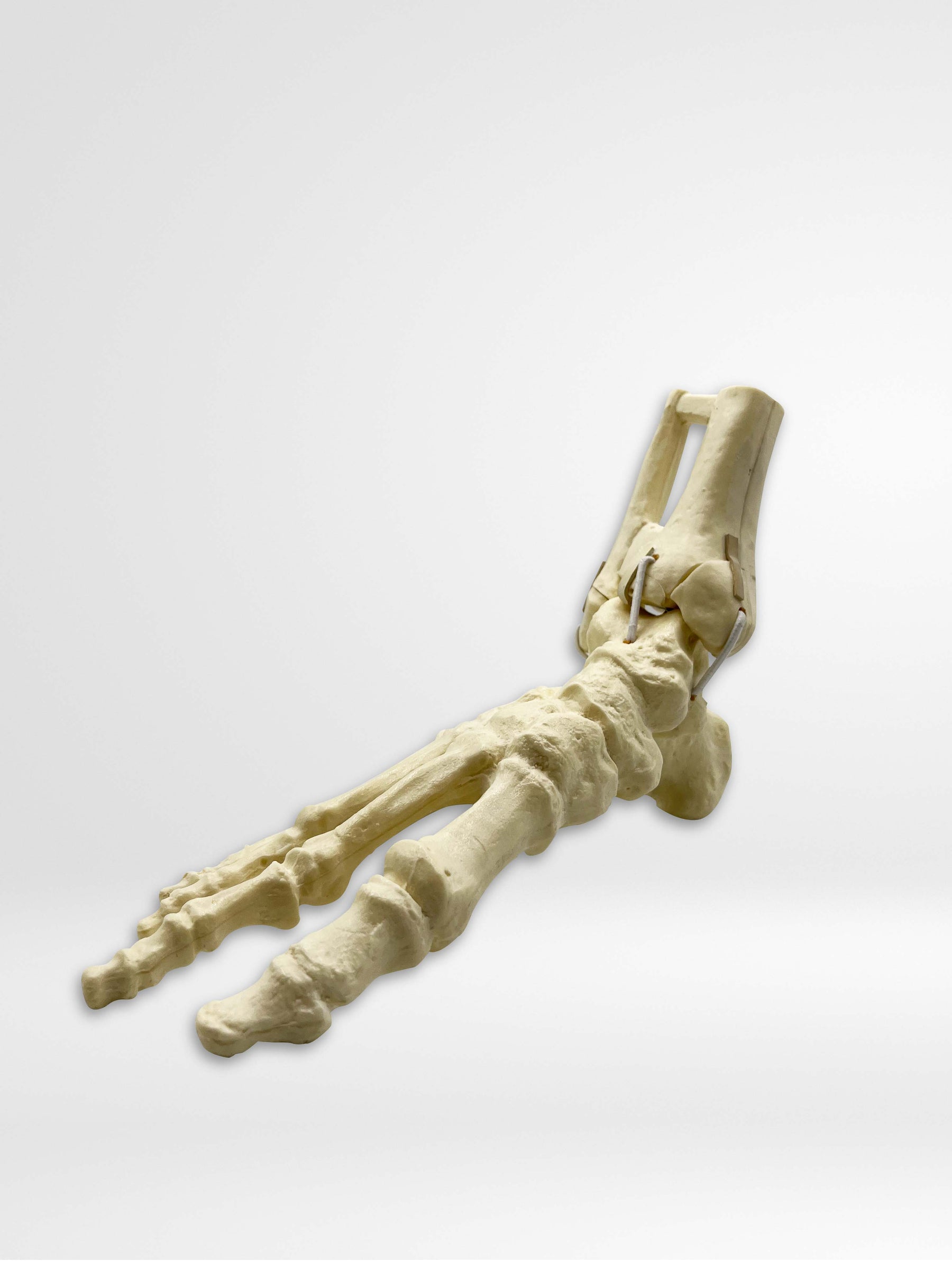 9699 - RIGHT ANKLE - FRACTURE 1