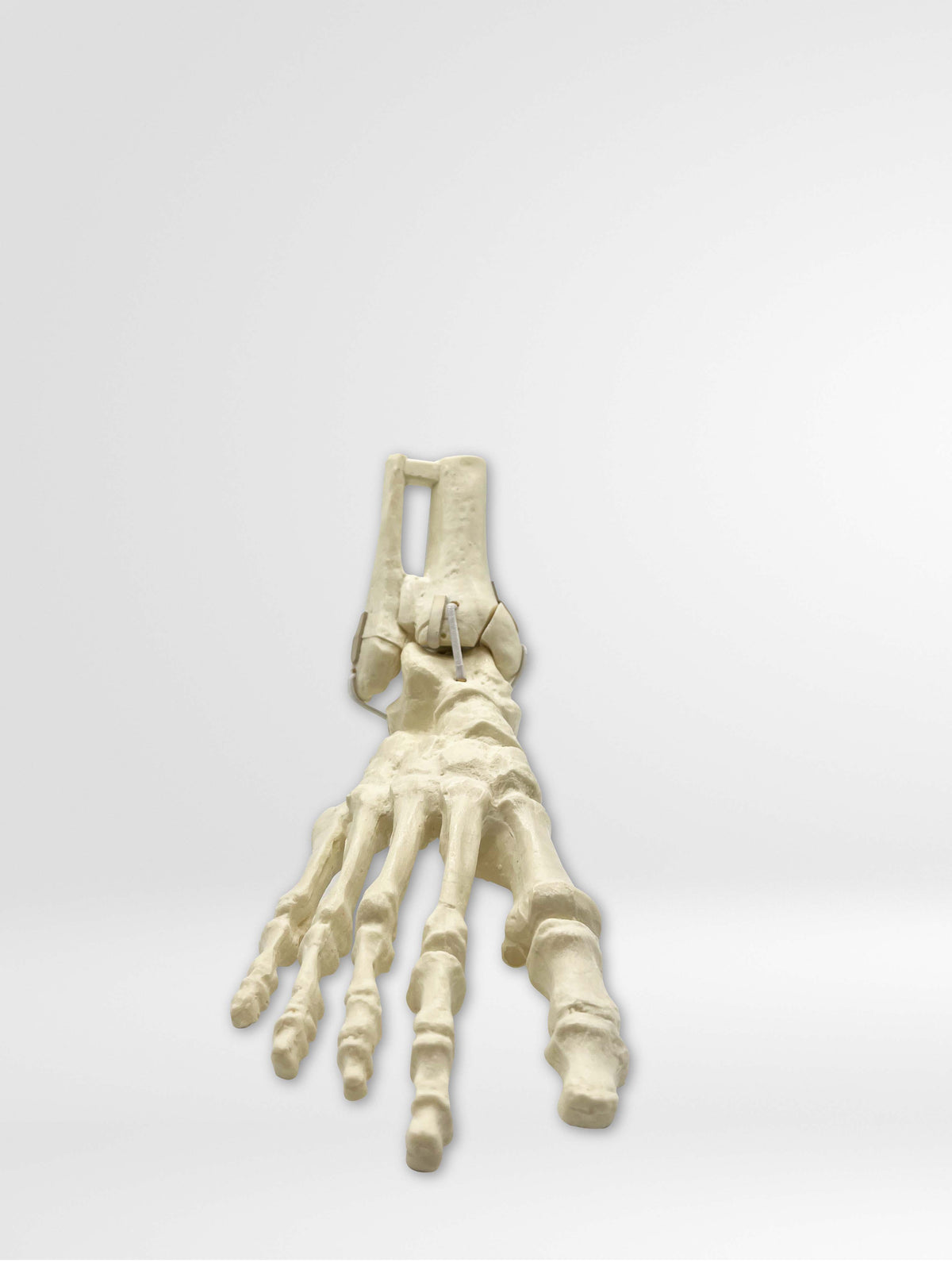 9699 - RIGHT ANKLE - FRACTURE 1