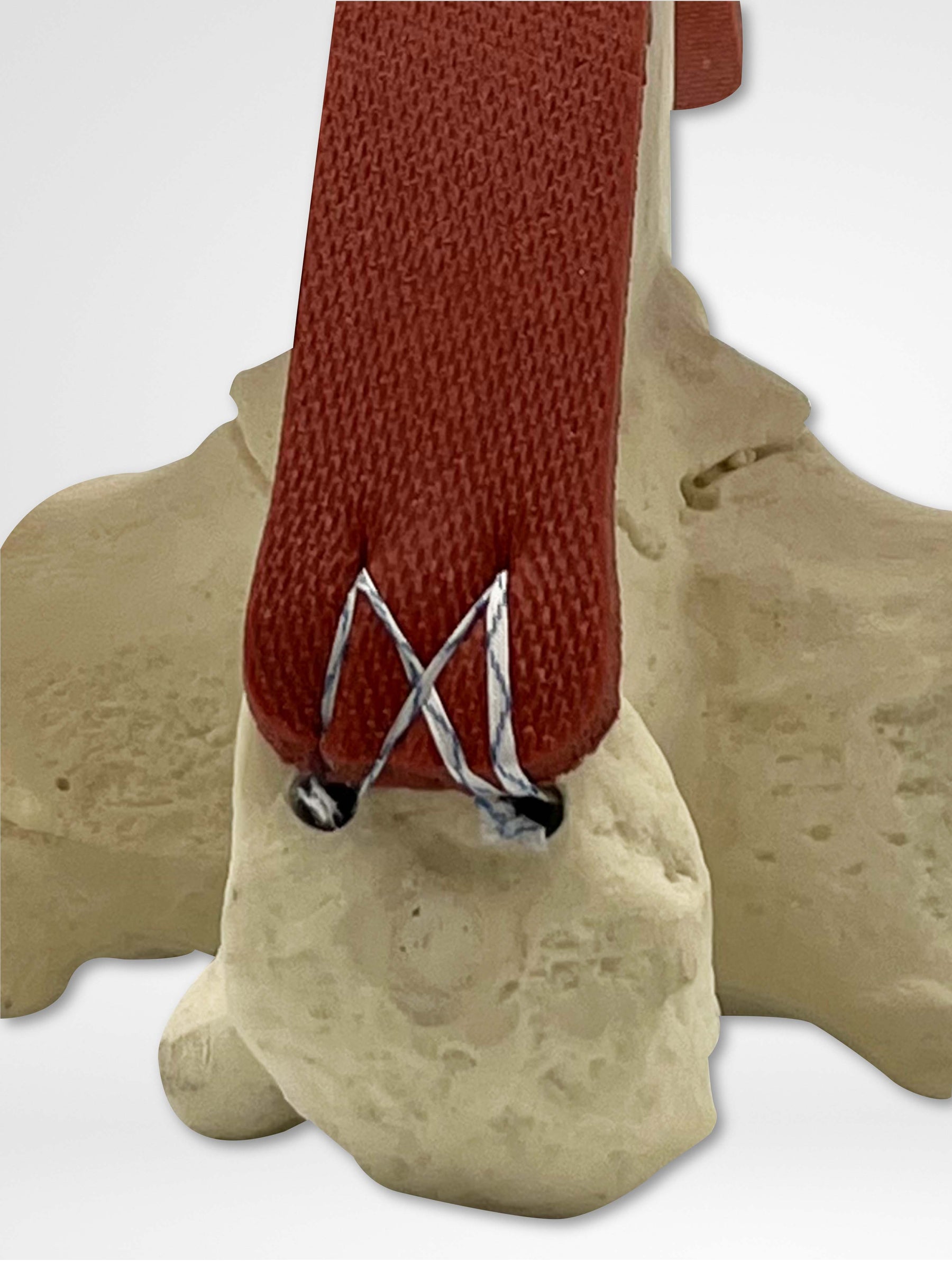 13521 - CALCVADER - Calcaneus Anchor Training Tool