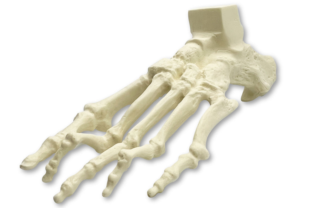 1006-01 - LEFT FOOT WITH DEFORMITIES