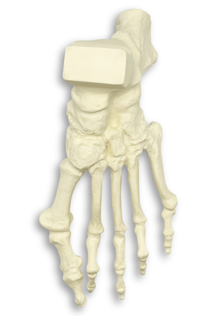 1006-01 - LEFT FOOT WITH DEFORMITIES