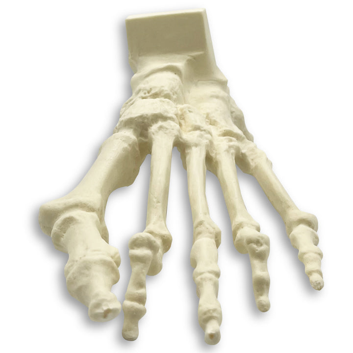 1006-01 - LEFT FOOT WITH DEFORMITIES