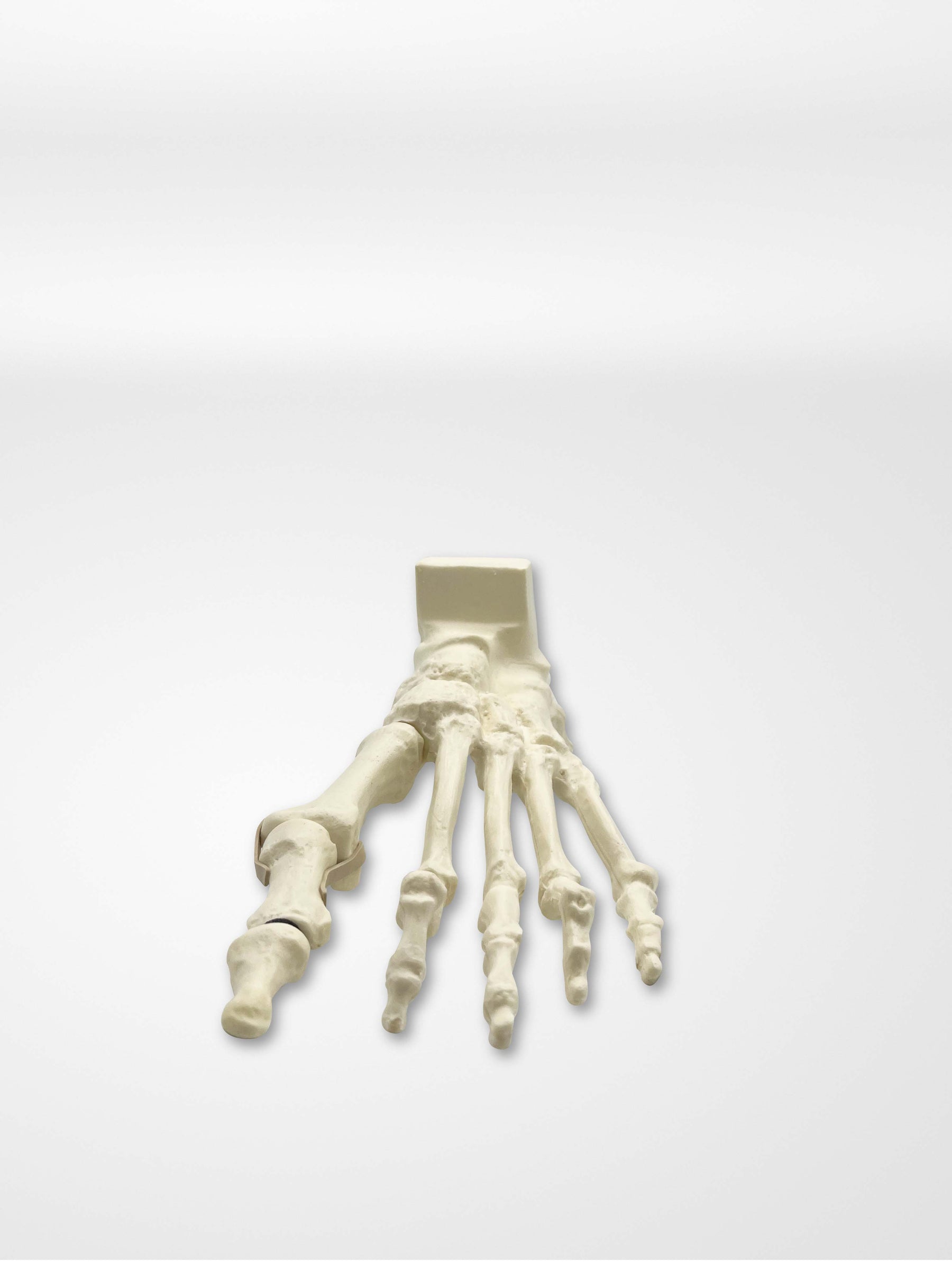 13635 - Rotation Lapidus and MIS Bunion trainer with Deformity