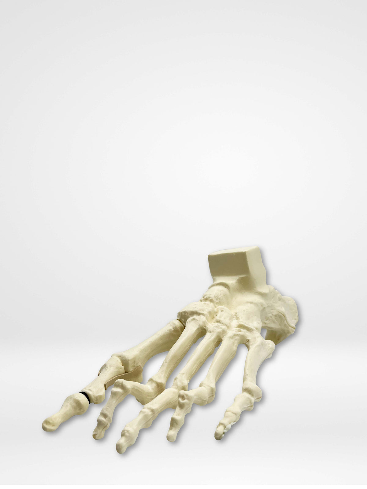 13635 - Rotation Lapidus and MIS Bunion trainer with Deformity