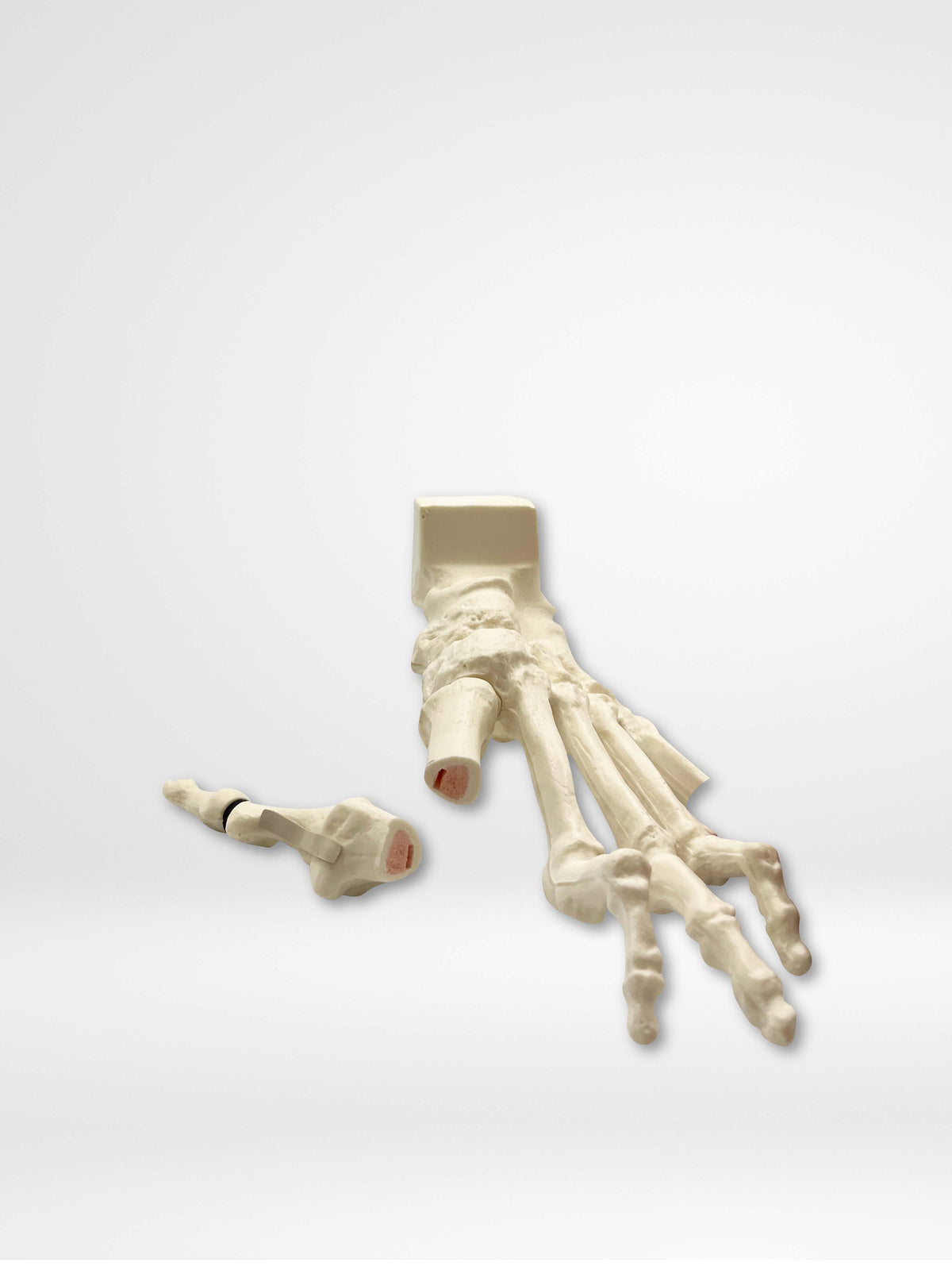 13635 - Rotation Lapidus and MIS Bunion trainer with Deformity