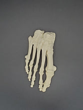 13416 - RIGHT FOREFOOT / MIDFOOT WITH DEFORMITY