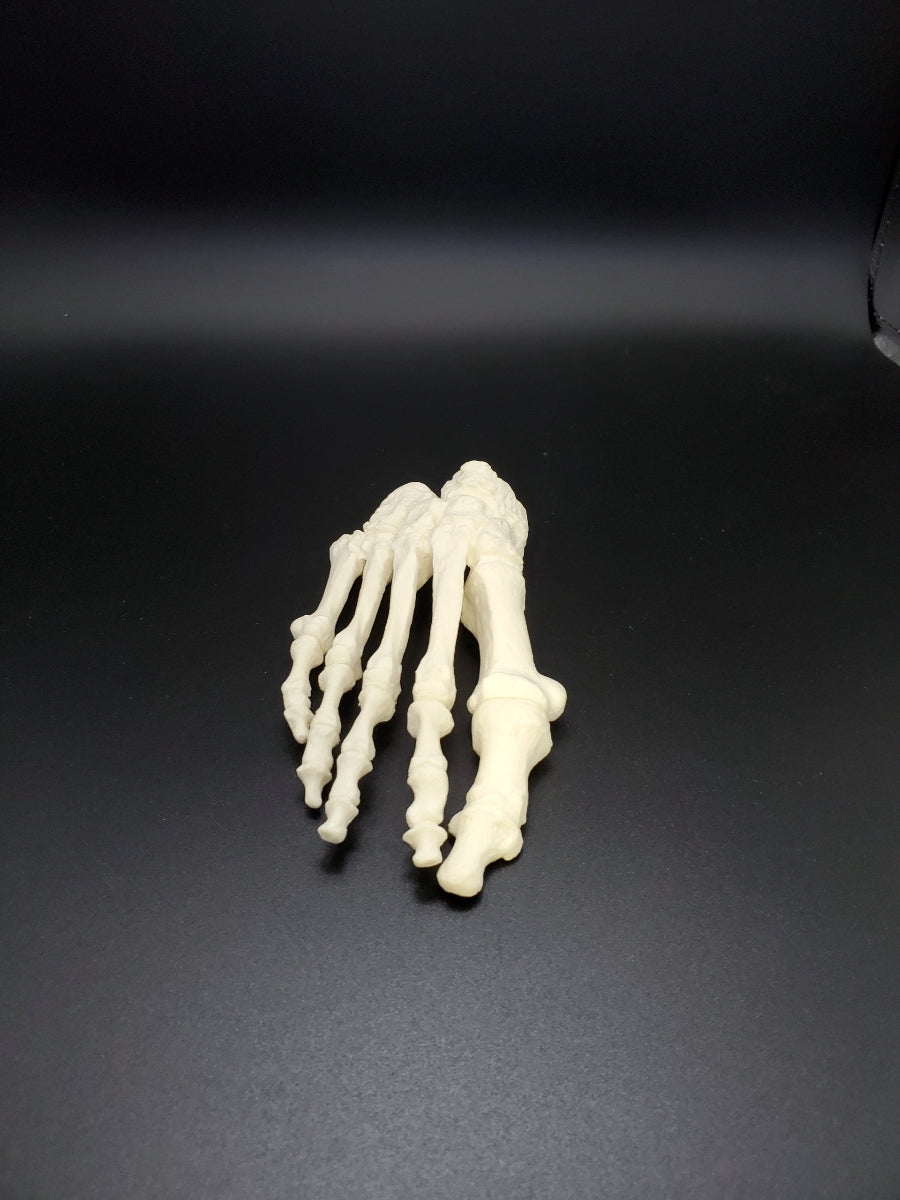 13416 - RIGHT FOREFOOT / MIDFOOT WITH DEFORMITY