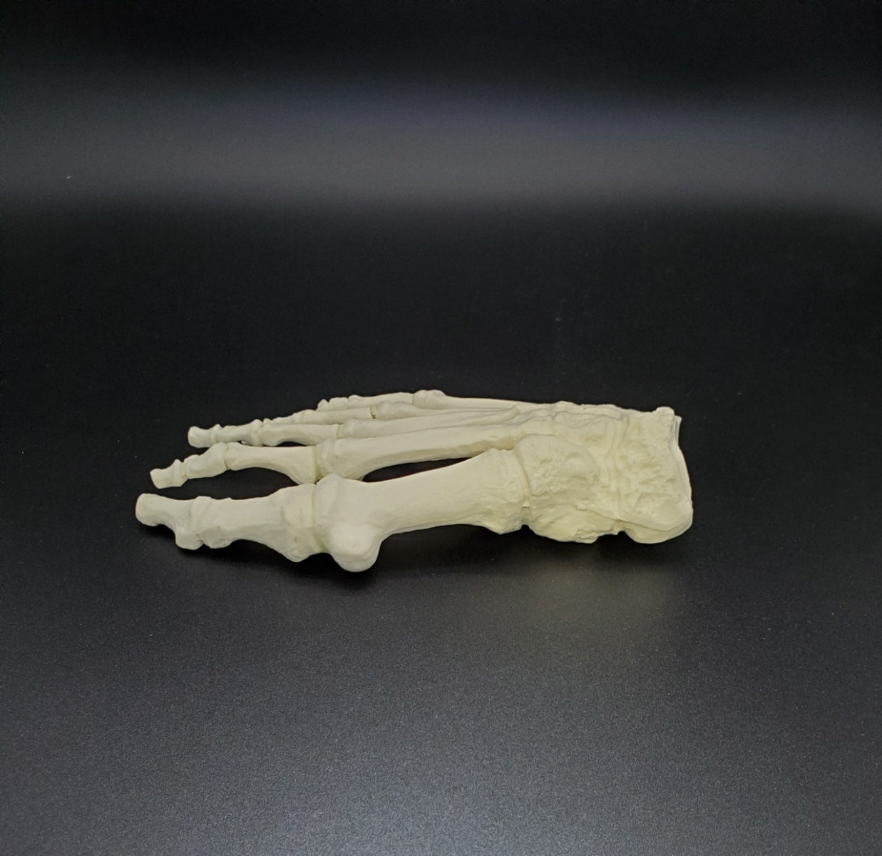 13416 - RIGHT FOREFOOT / MIDFOOT WITH DEFORMITY