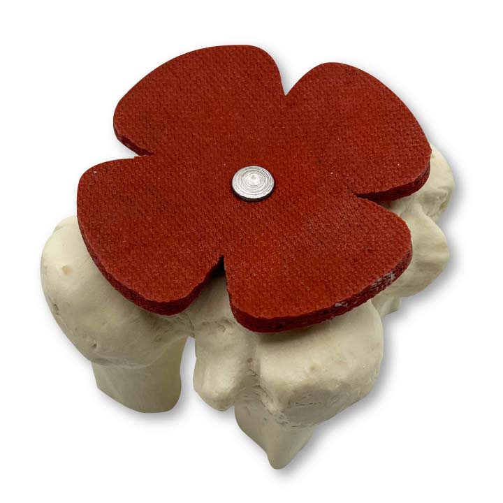 13520 - SHOLDYWAN - Anatomic Shoulder Anchor Trainer