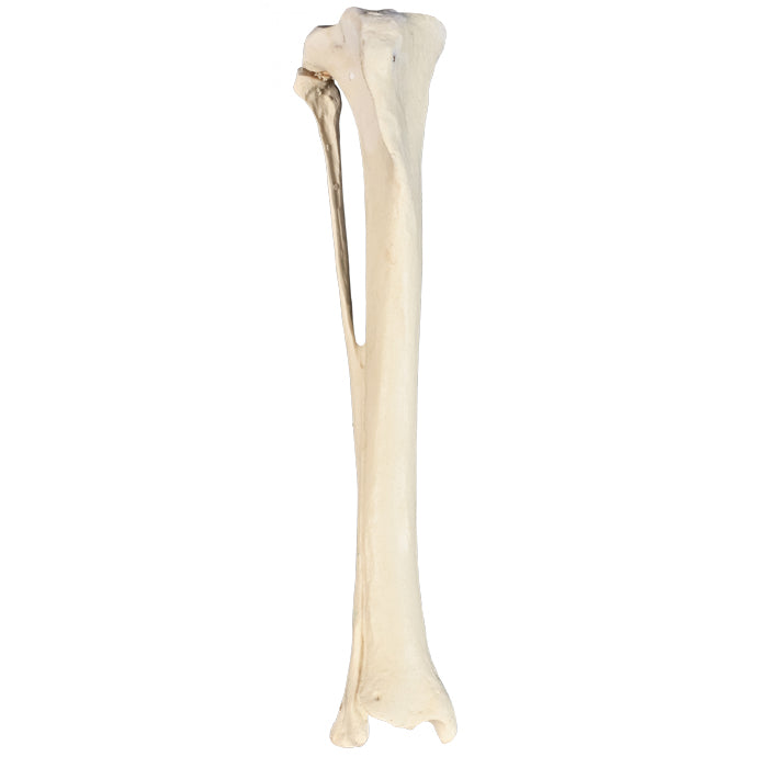 12661 - RIGHT TIBIA CANINE WITH FIBULA, MED. CANAL AND CANC. MATERIAL - RADIOPAQUE