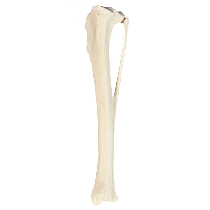 12661 - RIGHT TIBIA CANINE WITH FIBULA, MED. CANAL AND CANC. MATERIAL - RADIOPAQUE