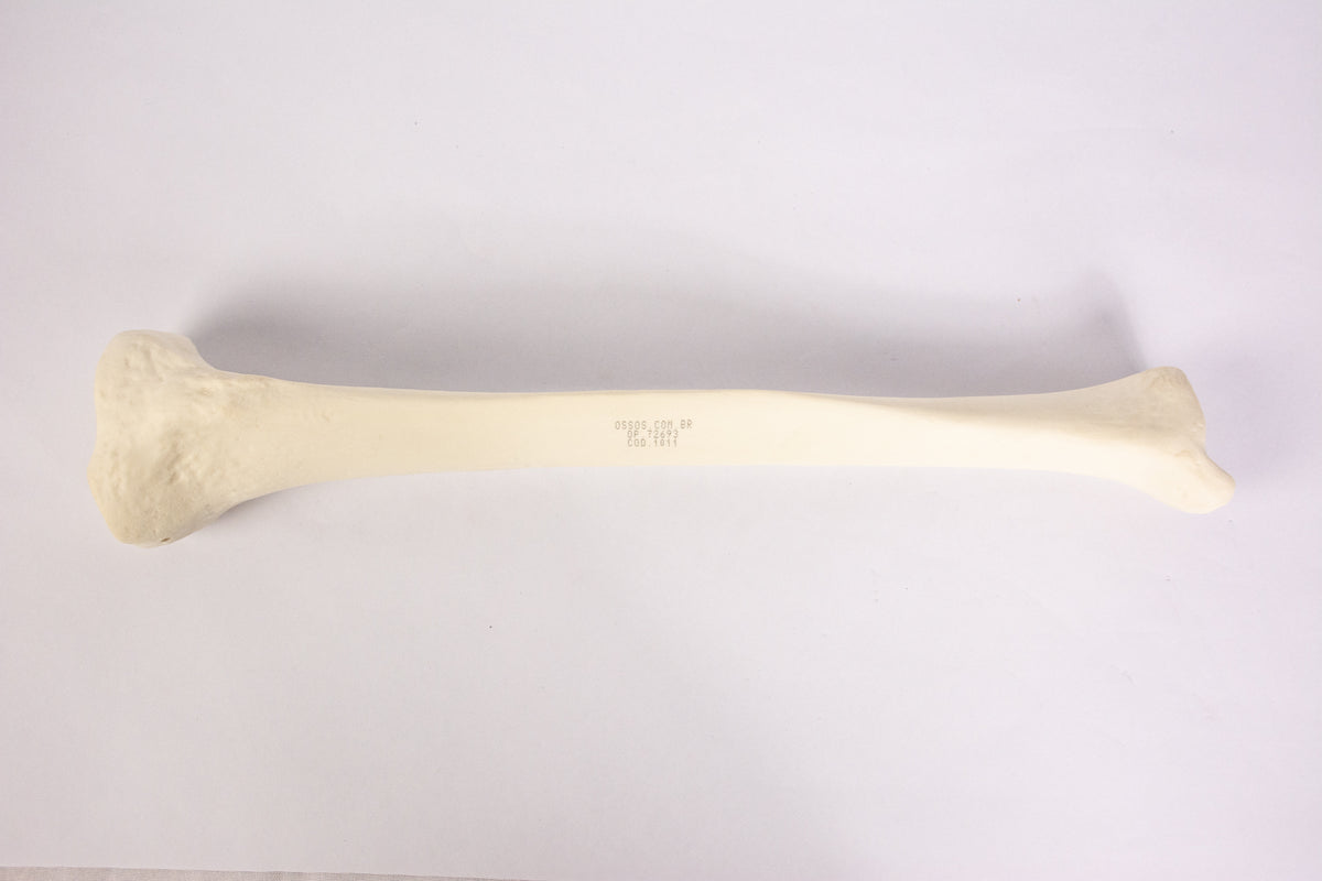 12373 - RADIOPAQUE LEFT TIBIA WITH CANCELLOUS MATERIAL AND MEDULLARY CANAL (IMP.)