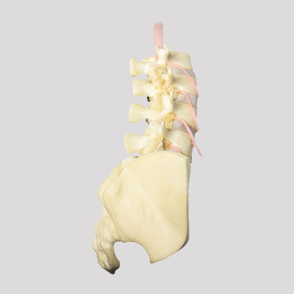 10476 - LUMBAR MODEL ESS