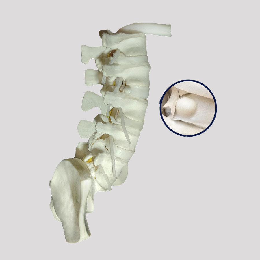 10476 - LUMBAR MODEL ESS