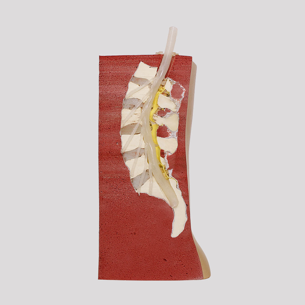 10476 - LUMBAR MODEL ESS