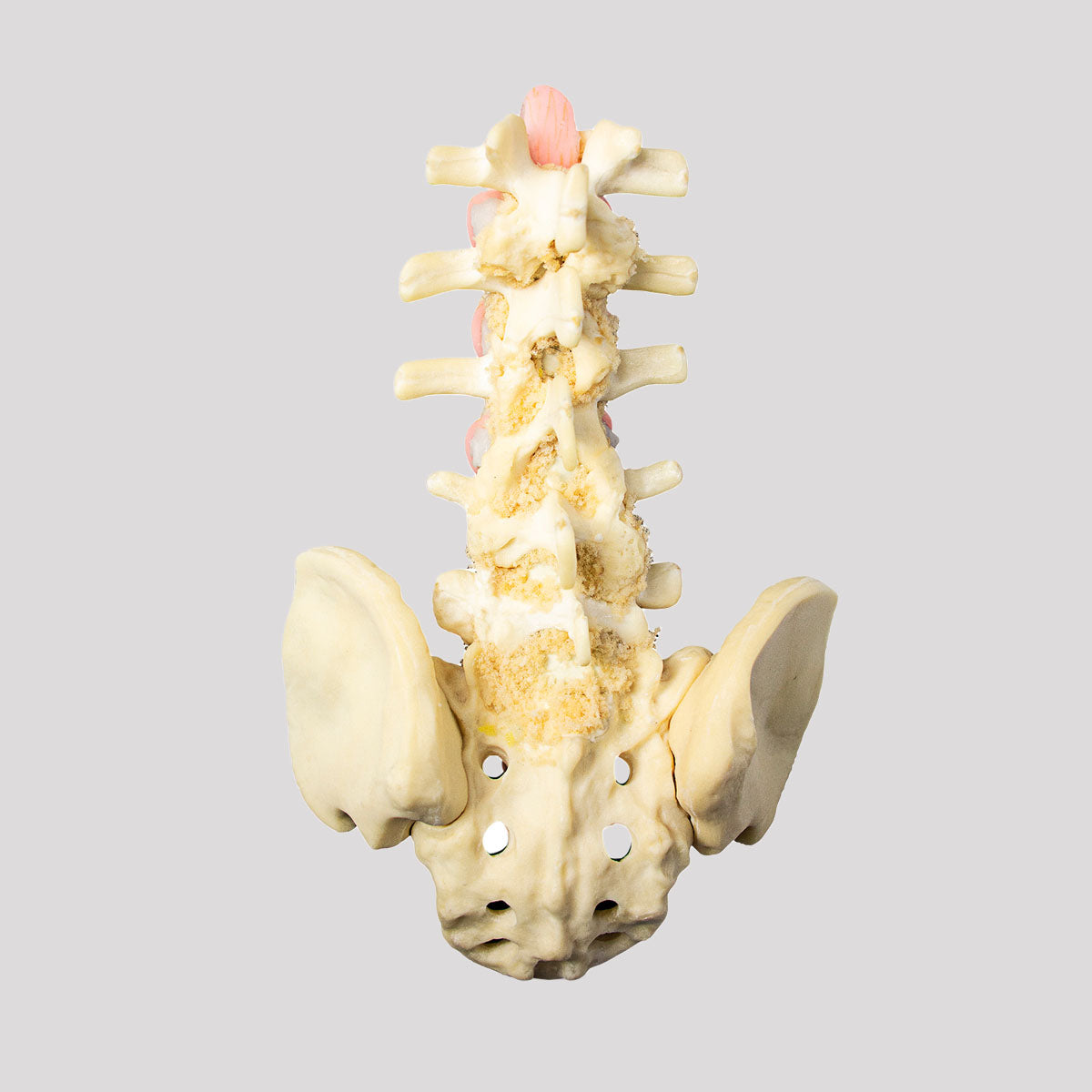 10476 - LUMBAR MODEL ESS