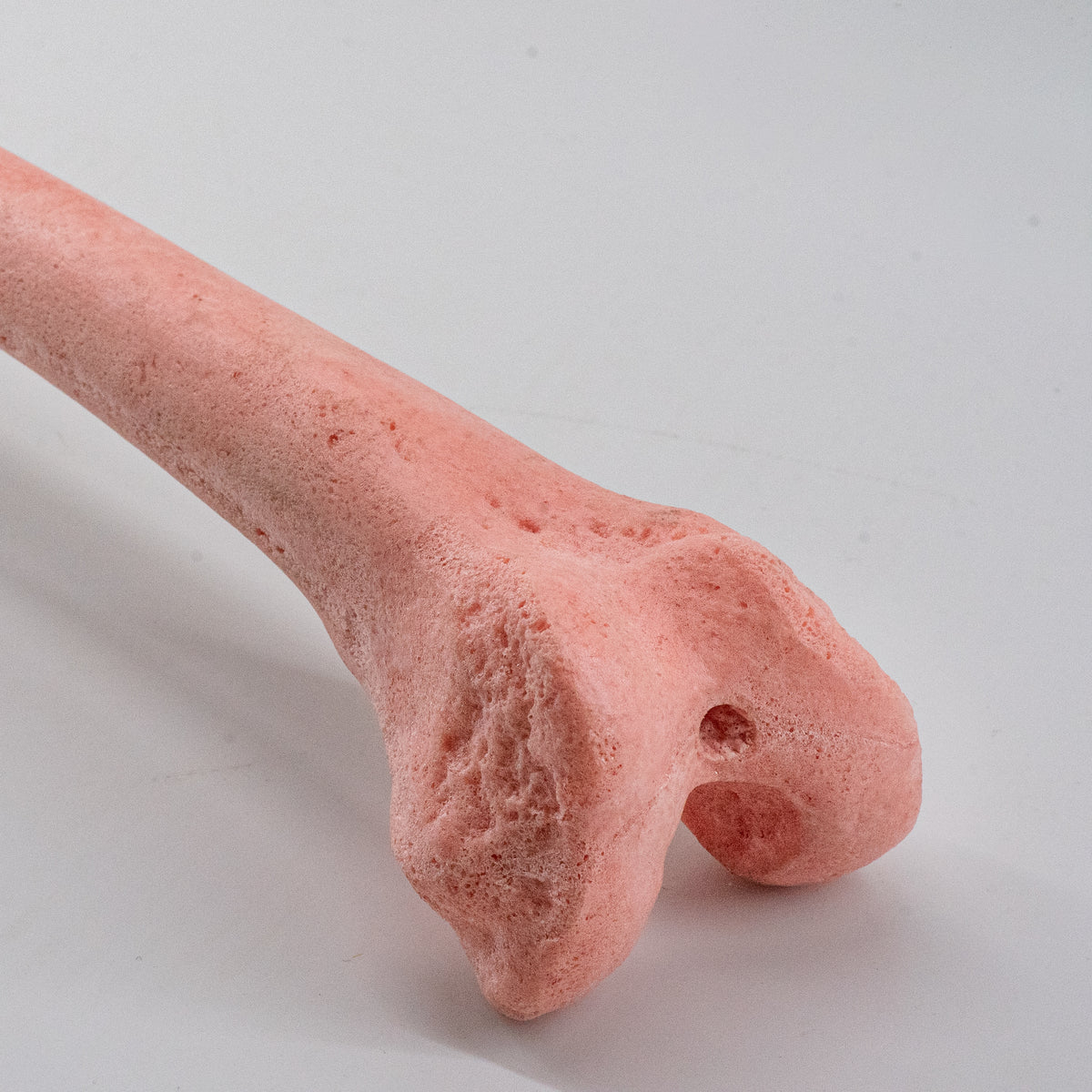 12938 - OSTEOPOROTIC RIGHT FEMUR