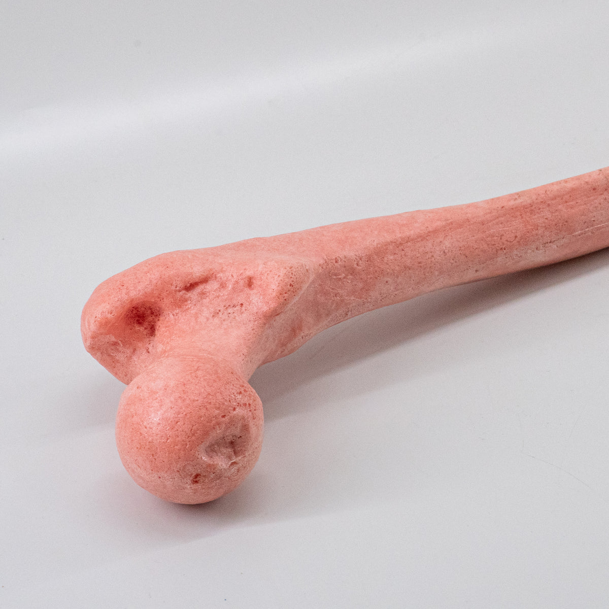 12938 - OSTEOPOROTIC RIGHT FEMUR