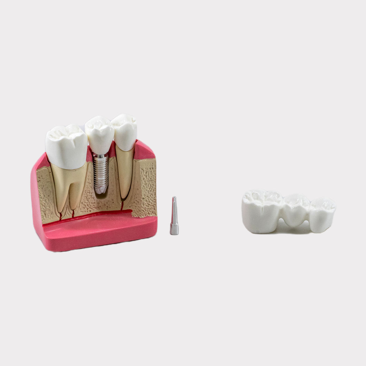 8007 - MACRO MODEL POST AND CORE