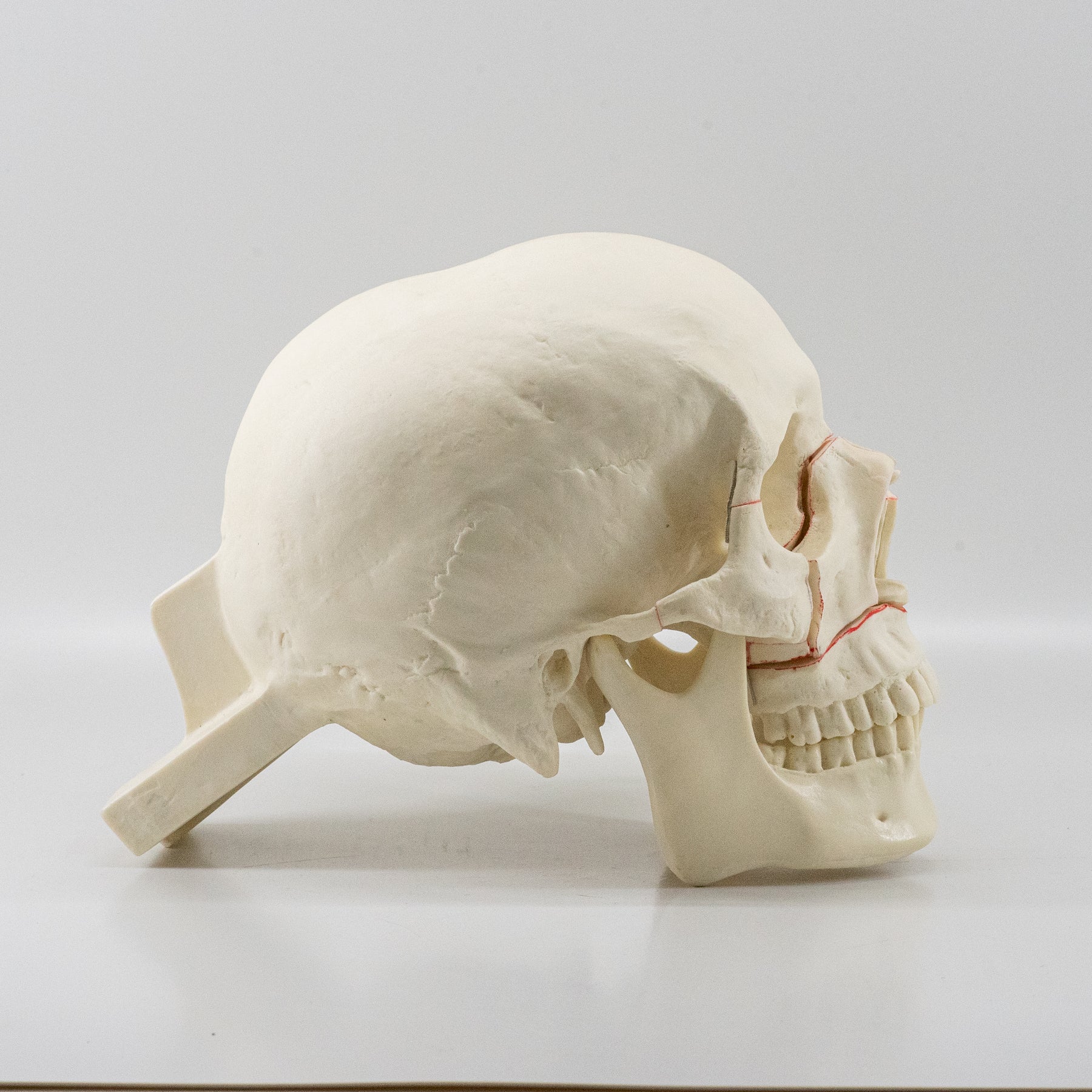 10559 - SKULL WITH MAXILLARY CUTS