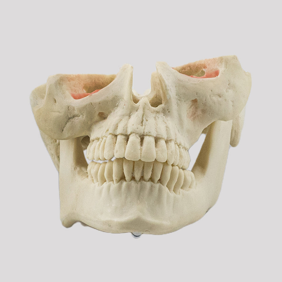 12789 - MODEL WITH SEVERE FACIAL ASYMMETRY