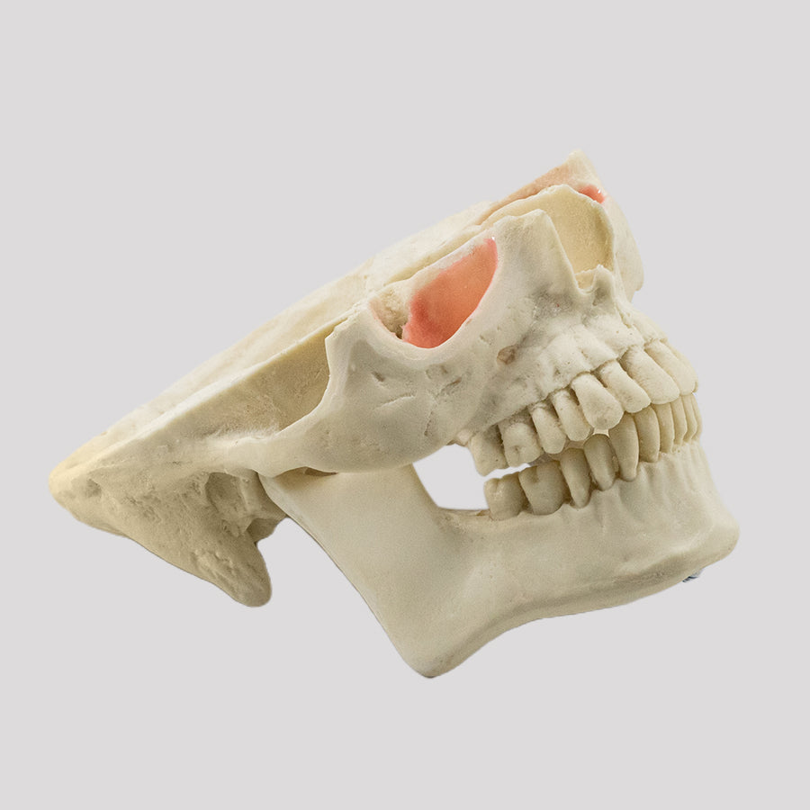 12789 - MODEL WITH SEVERE FACIAL ASYMMETRY