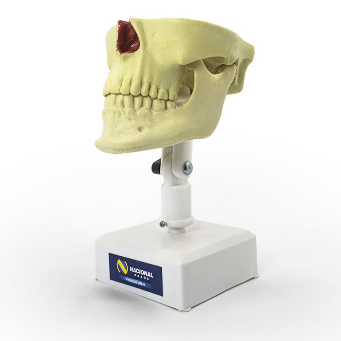 4402 - MODEL WITH ALL TEETH AND ENCLOSED 3RD MOLAR