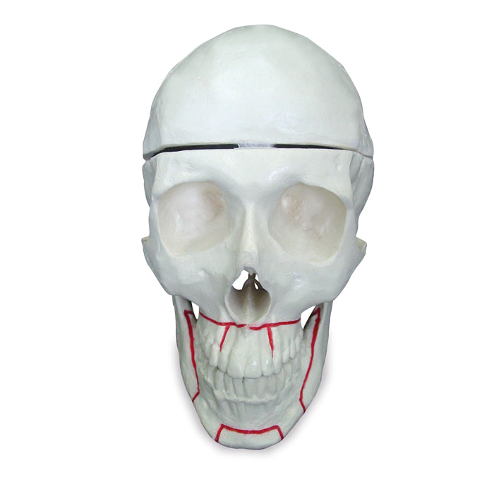 9002 - SKULL WITH ORTHOGNATIC CUT