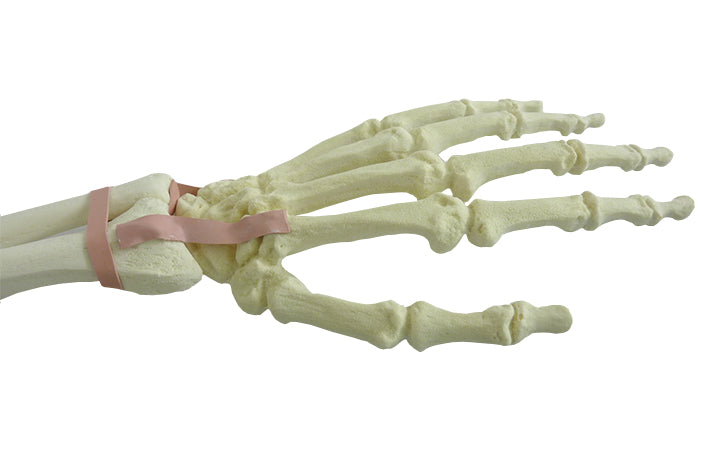 S1017 - LEFT SUPERIOR LIMB W/ SUPINATION AND PRONATION MOVIMENT
