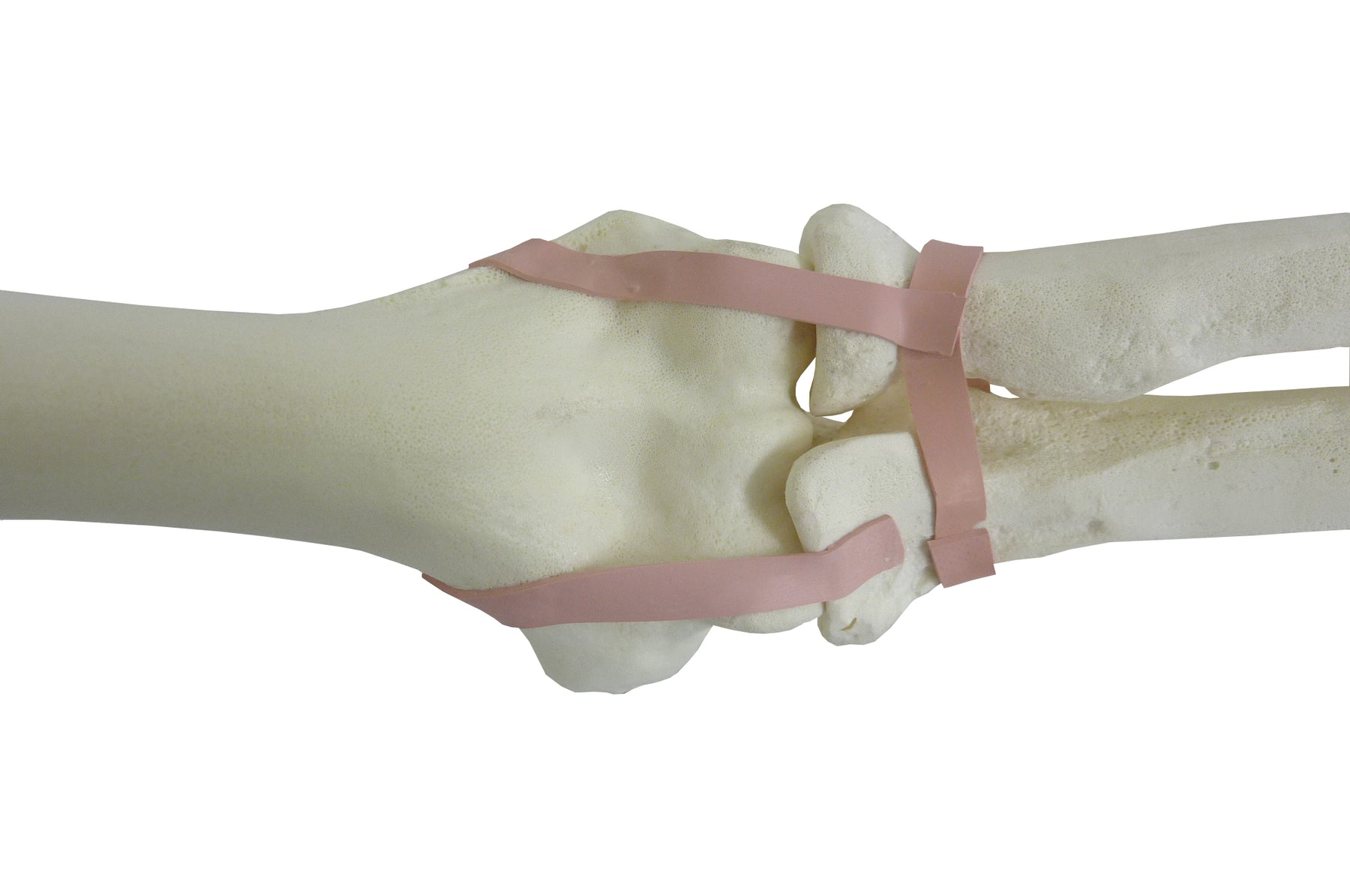 S1017 - LEFT SUPERIOR LIMB W/ SUPINATION AND PRONATION MOVIMENT