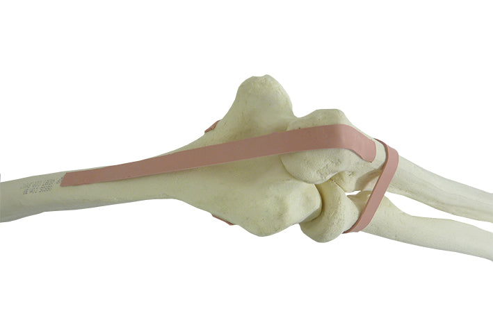 S1017 - LEFT SUPERIOR LIMB W/ SUPINATION AND PRONATION MOVIMENT