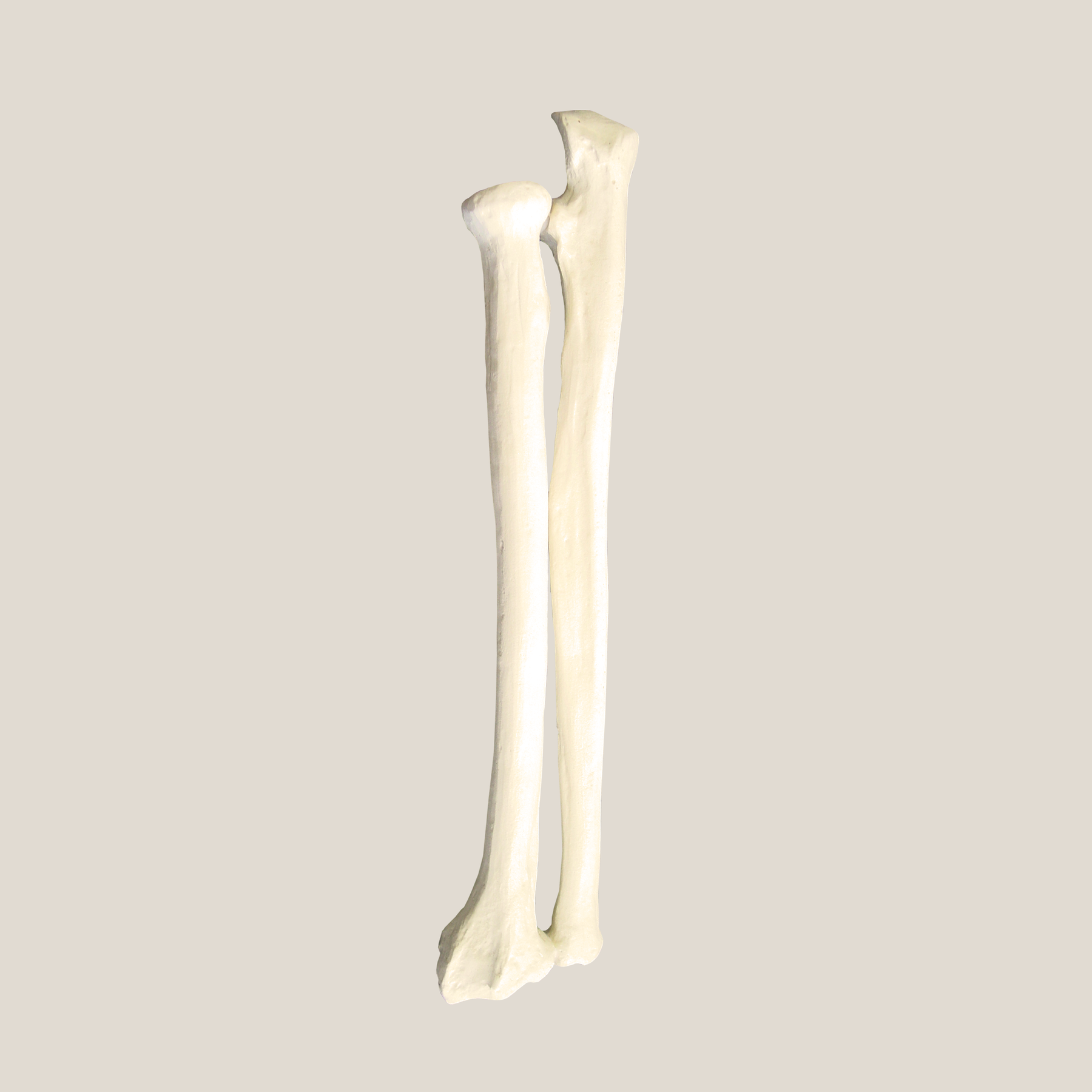 12340 - RADIOPAQUE LEFT RADIUS AND ULNA IMP