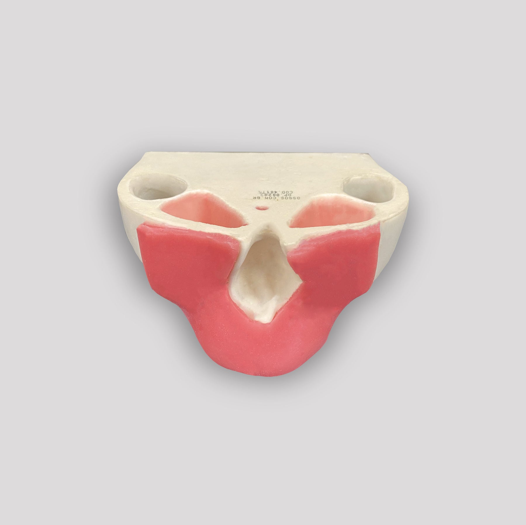 4017G - EDENTULOUS MAXILLA WITH GUM