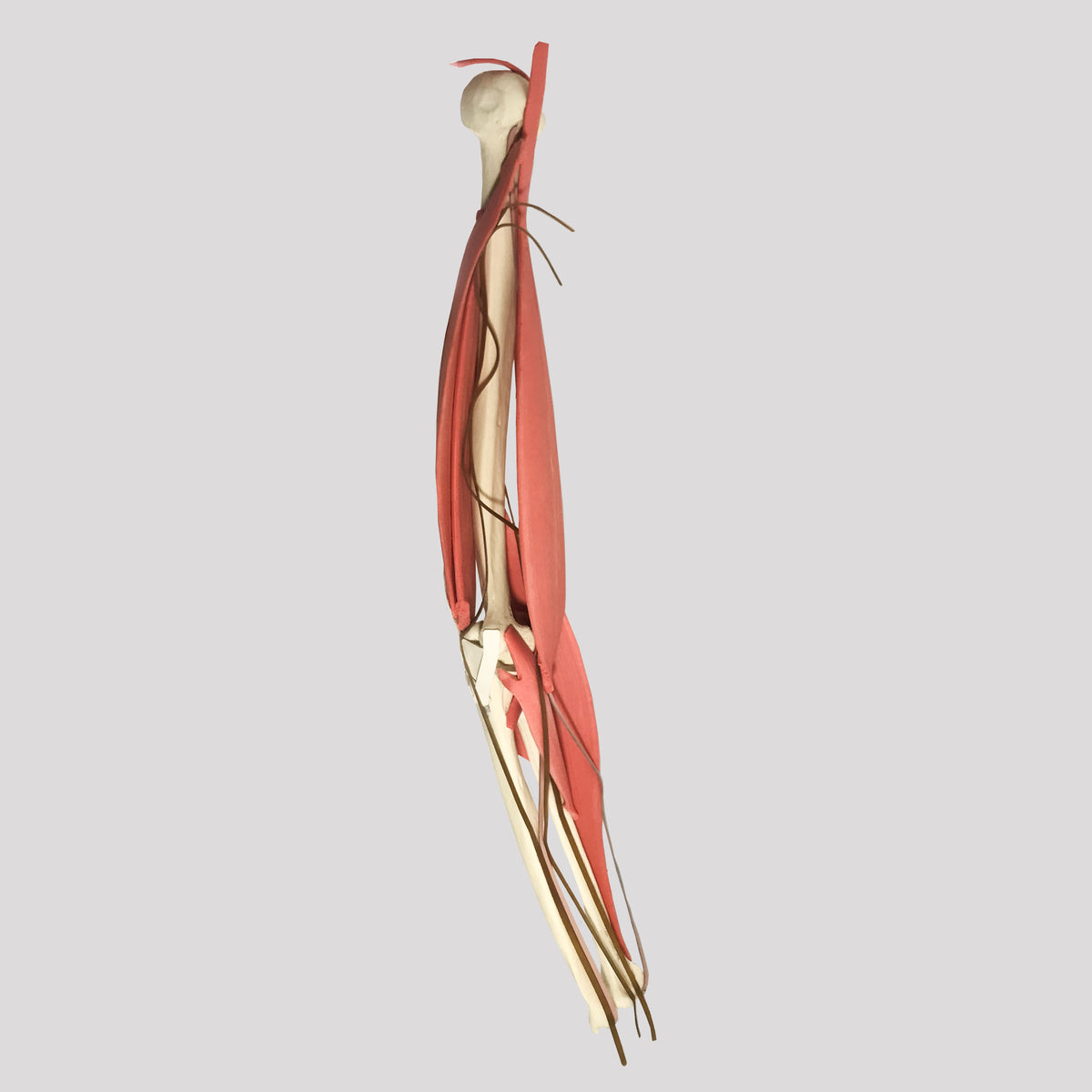 11309 - LEFT ELBOW WITH COMPLETE STRUCTURES