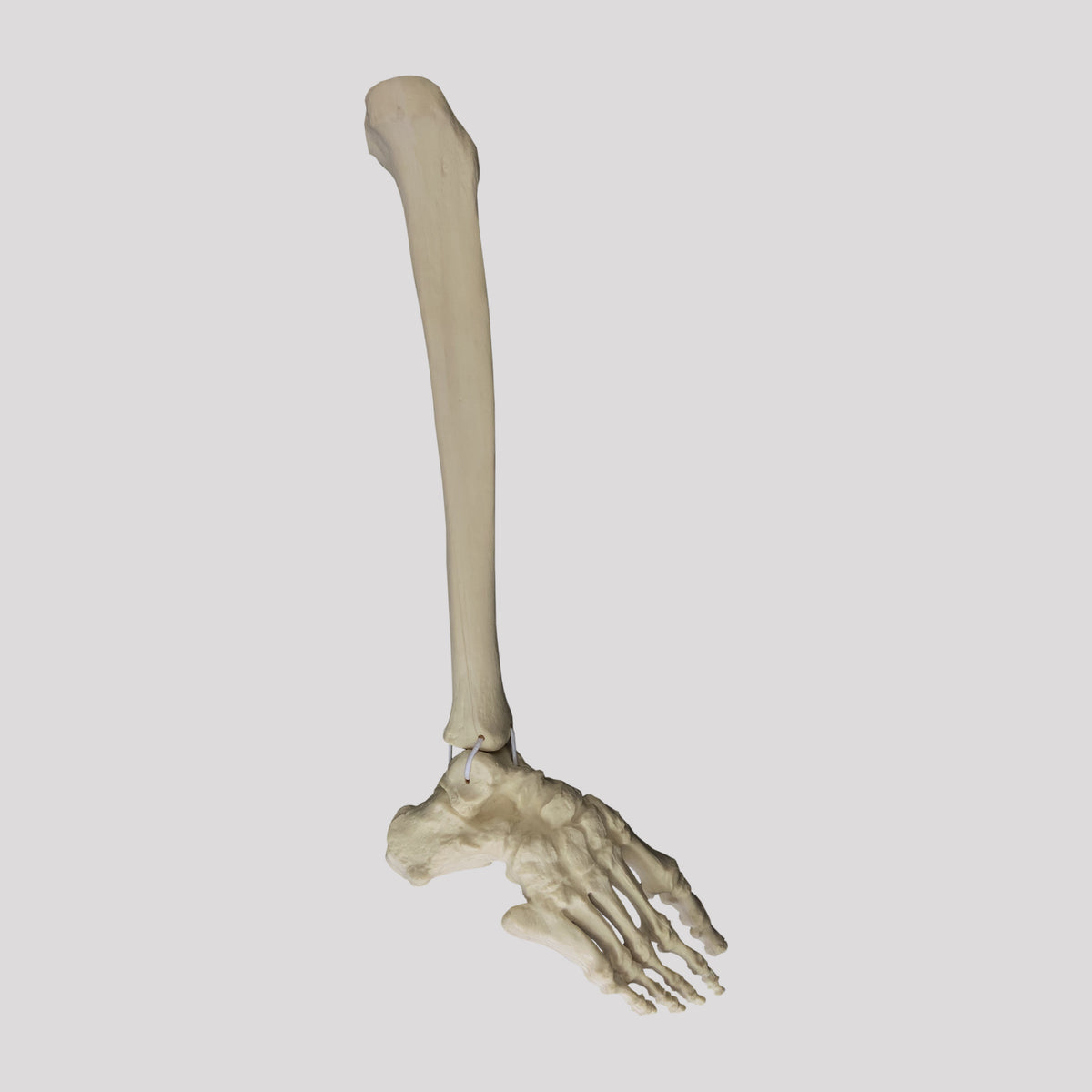 12454 - RIGHT CONGENITAL  FOOT WITH TIBIA