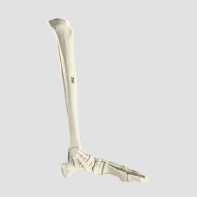 2026PI-01 - LEFT ANKLE - TIBIA, FIBULA AND FOOT