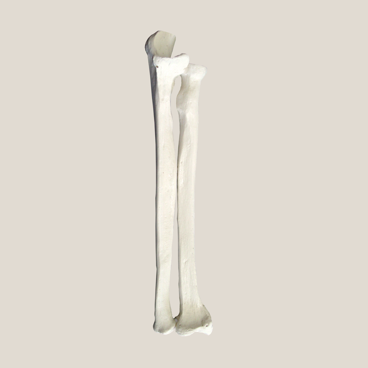 1014 IMP - LEFT RADIUS AND ULNA