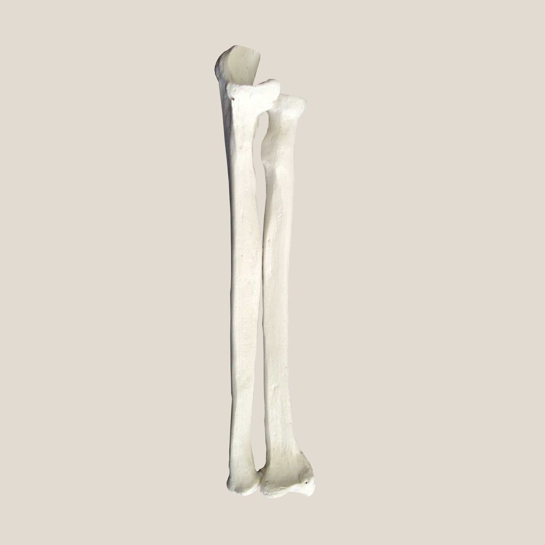 1014 IMP - LEFT RADIUS AND ULNA