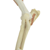 9876 -  FRONT LEG WITH FRACTURES - BIG DOG