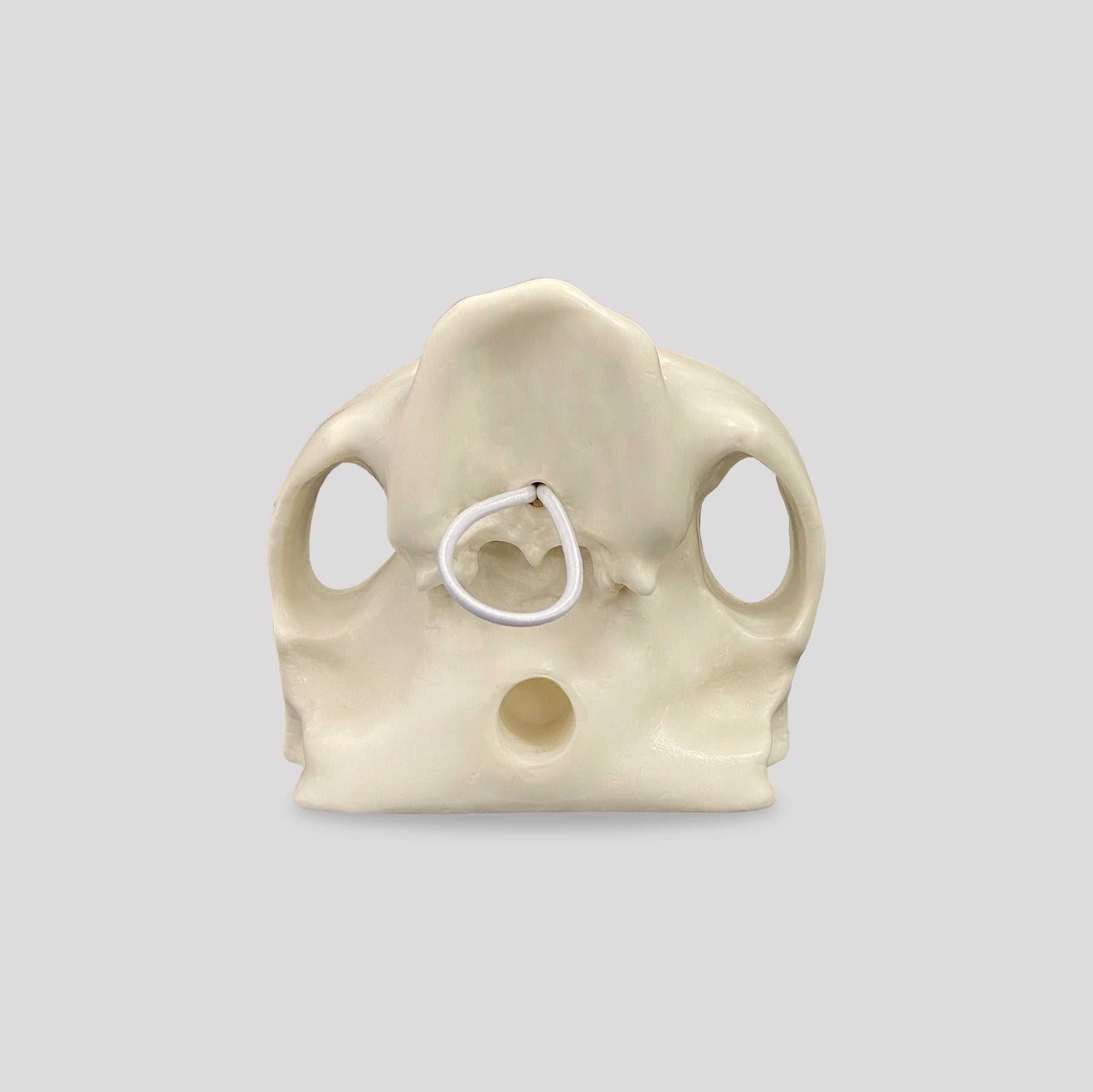 4017 - EDENTULOUS MAXILLA